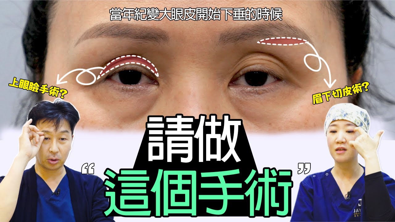 #眼皮下垂 #上眼瞼 #眉下切皮術