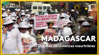 Madagascar : les albinos victimes de violences meurtrières