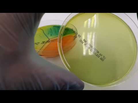 Microbiology: Hektoen Enteric agar