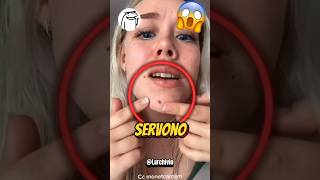 Ma A Che Servono I Nei? 😱 Resimi