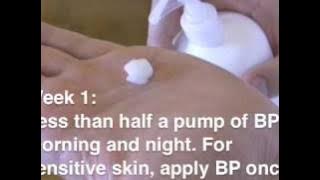 Biggest mistakes people make on The Acne.org Regimen
