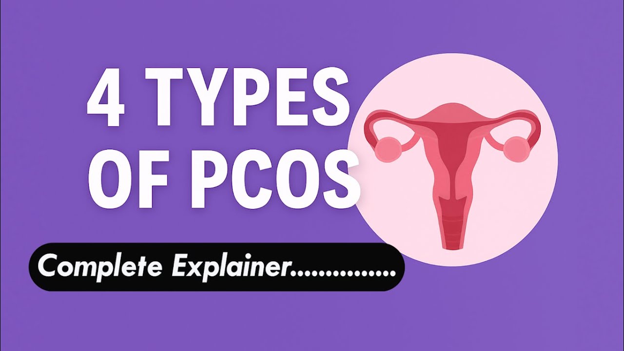 Типы СПКЯ: причины, симптомы, фенотипы и лечение.