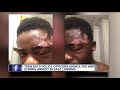 Teen says police officers assaulted him during arrest in east lansing