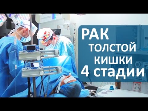 Лечение рака 4 стадии. Хирургическое лечение рака толстой кишки 4 стадии. Клиника колопроктологии.