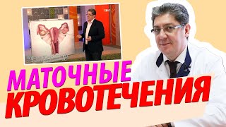 видео Кровотечения: первая помощь, виды и признаки, способы остановить