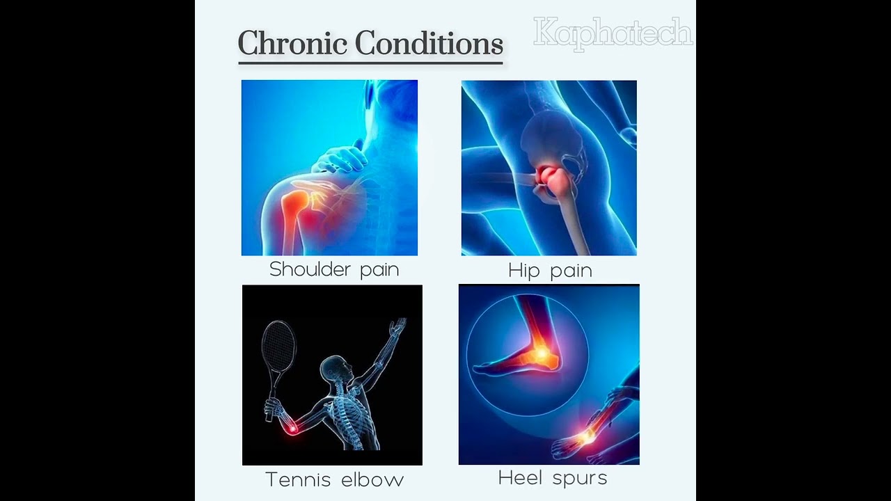 White Shockwave Therapy Professional Digital Touch Screen ED Treatment and Physiotherapy