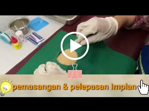 Video: Diagnosis Cepat Jangkitan Implan Berkaitan Ortopedik Menggunakan Implan ITU Unyvero Dan Jangkitan Tisu Tidak Optimum Untuk Pengenalan Spesies Staphylococcus