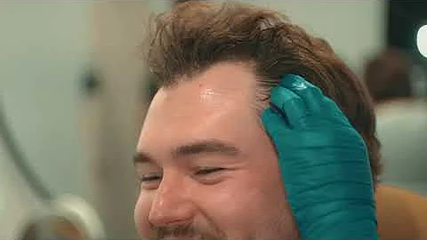 PRF or Platelet Rich Fibrin treatment for Hair Loss or Thinning Hair