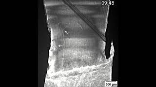 Dislokasjonsbevegelser I Solcellesilisiumdislocation Movement In Solar Silicon