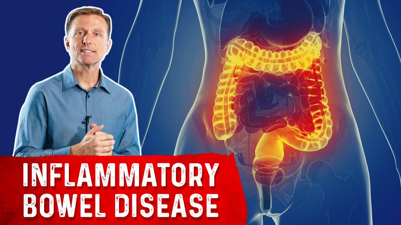 does semaglutide cause colitis Can Ozempic (semaglutide) constipation and stercoral colitis? Does Ozempic Cause Constipation? What