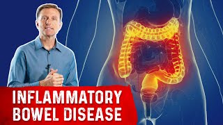 The Most Common Nutrient Deficiency in IBD (Inflammatory Bowel Disease) screenshot 3