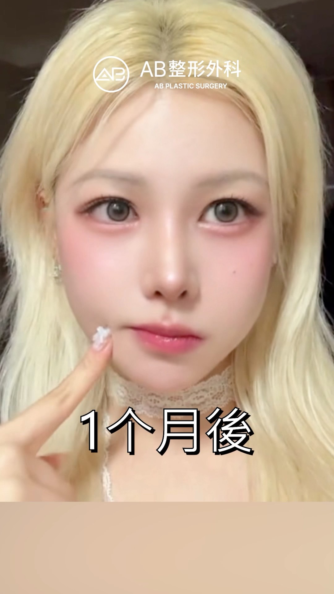 韓國整形改變一切！震撼的前後對比 #shorts