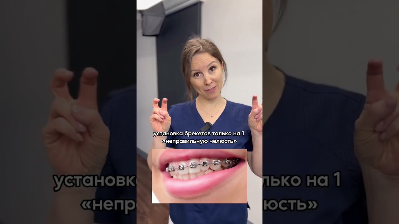 👉 Почему брекеты ставят на обе челюсти?