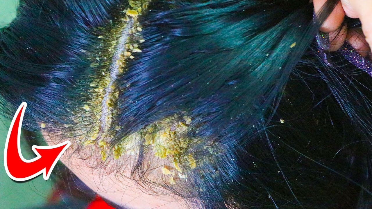 Satisfying Removal 242 YouTube