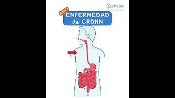 ¿Se hacen cacas mucosas con Crohn?