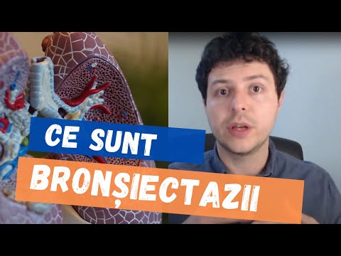 Video: Bronșiectazii: Simptome, Tratament, Diagnostic, Cauze