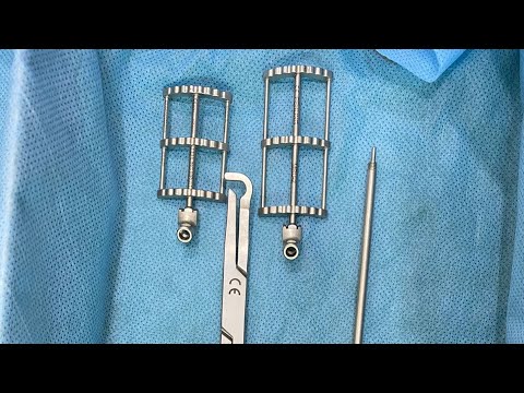 Mini Mvr Vs Normal MICS MVR Instruments and Set up - YouTube