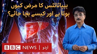 What are early signs of Hepatitis and is there a way to prevent it?- BBC URDU