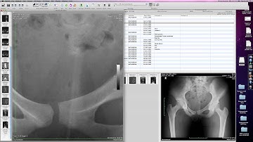 009 Adding files to osirix