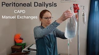 Peritoneal Dialysis (PD) Manual Exchanges: StepbyStep Guide in 2023