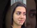 Narahat olmayin duzeltdik👍 #microblading #microbladedbrows #beauty #microbladingbrows #shorts