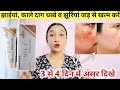MEL-X melasma cream full review in hindi / झाईयों को साफ करने की बेस्ट होम्योपैथिक क्रीम |2024