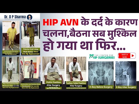 HIP AVN Treated