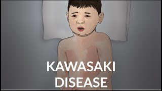 "Kawasaki Disease" by Lucy Rubin and Lisa DiPietro, MD for OPENPediatrics