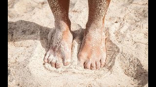 SAND FLEA BITES: HOW TO DEAL WITH THE BITES
