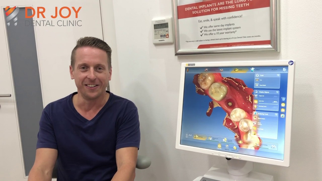Dental Implants | Patient Testimonial | Dr Joy Dental Clinic - Dubai