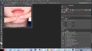 Как с помощью Photoshop убрать прыщи с лица(, 2013-11-13T11:05:51.000Z)