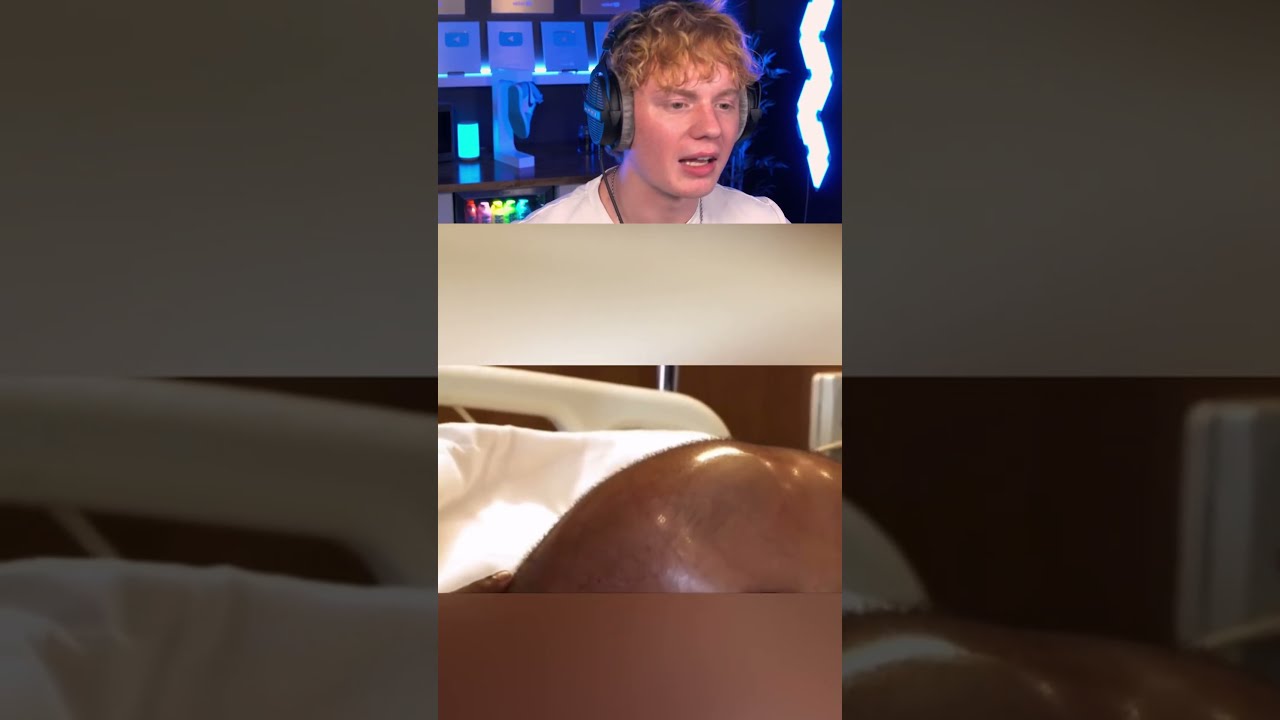 People With The Biggest Body Parts 