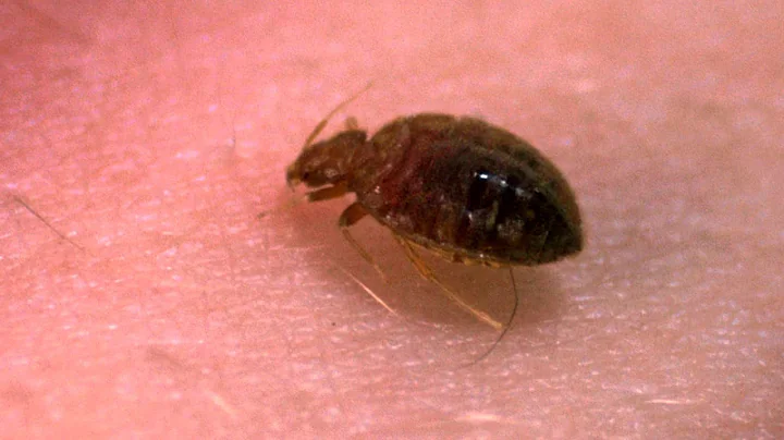 A Bedbug's Bite - Up Close! - Bang Goes the Theory - BBC - DayDayNews