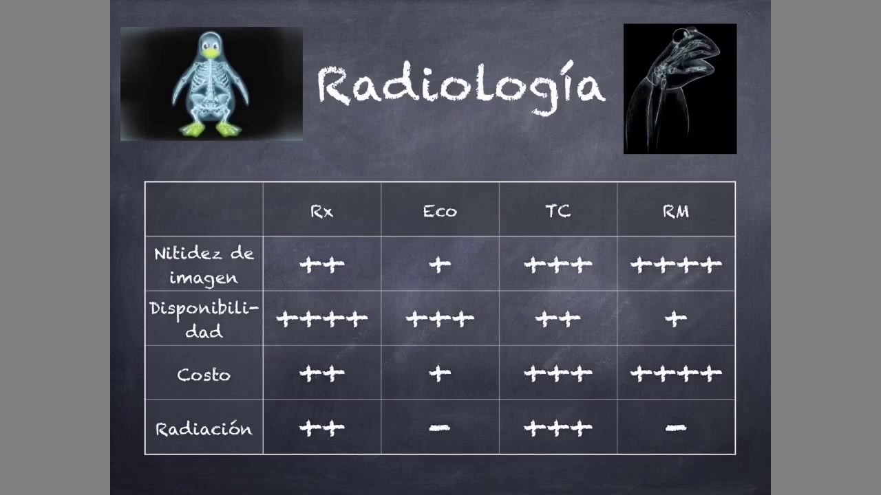 Introducción a la Tomografía Computarizada