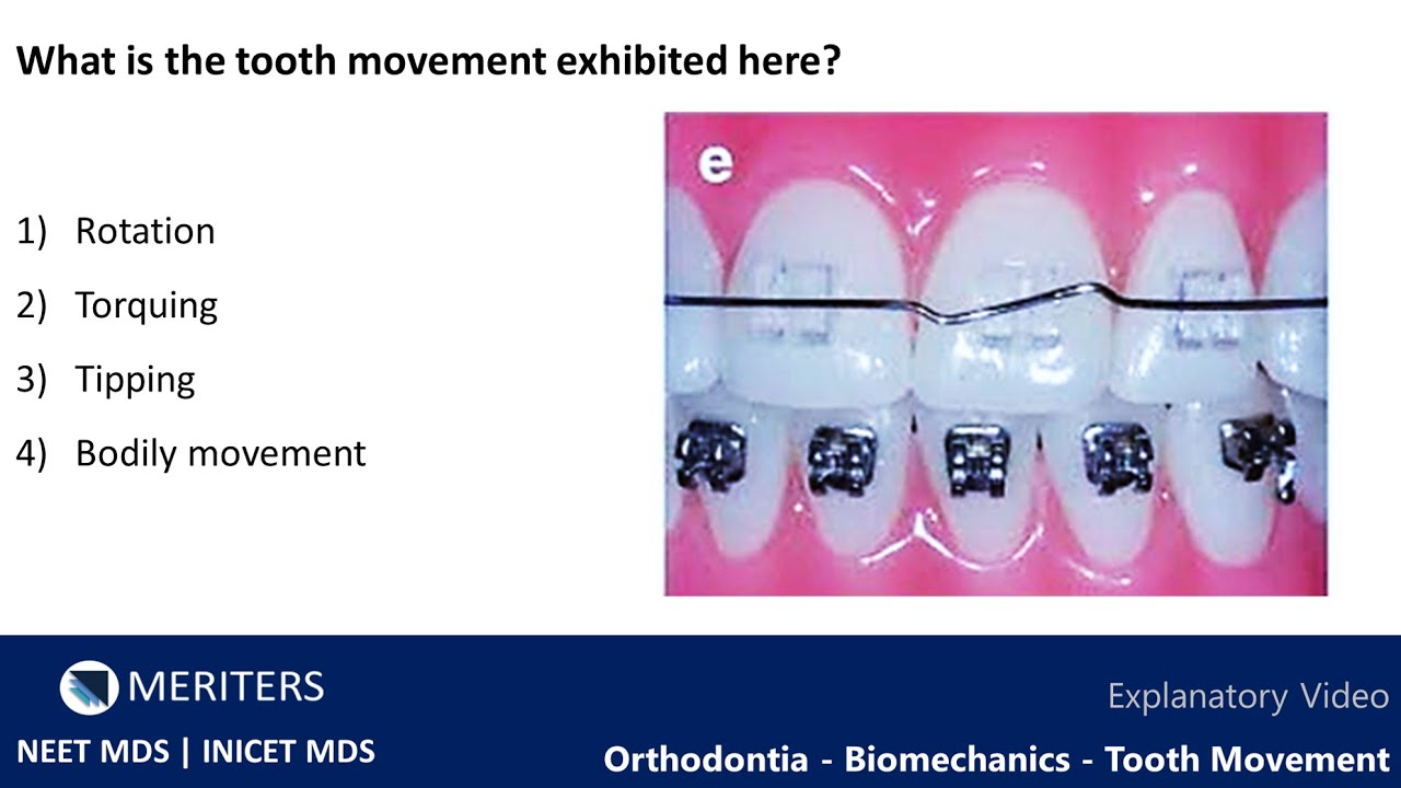 NEET MDS INICET Orthodontia Biomechanics Tooth Movement Explanatory Video MERITERS