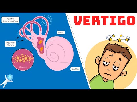 Vertigo from BPPV - Causes, Symptoms and Treatment