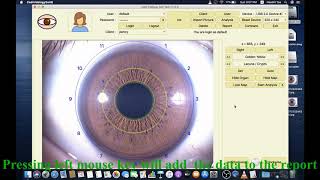 How To Use USB Iriscope Iris Analyzer Iridology Camera Software - Video Tutorial For Iridologist screenshot 4