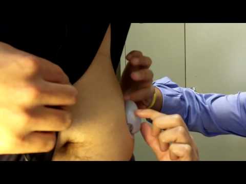 diabetes-video-blog-#4--omnipod-demo-part-1