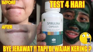 MASKER BUAT JERAWAT , JADI CEPAT KERING! | SPIRULINA CAPSULES REVIEW | Maria Soelisty