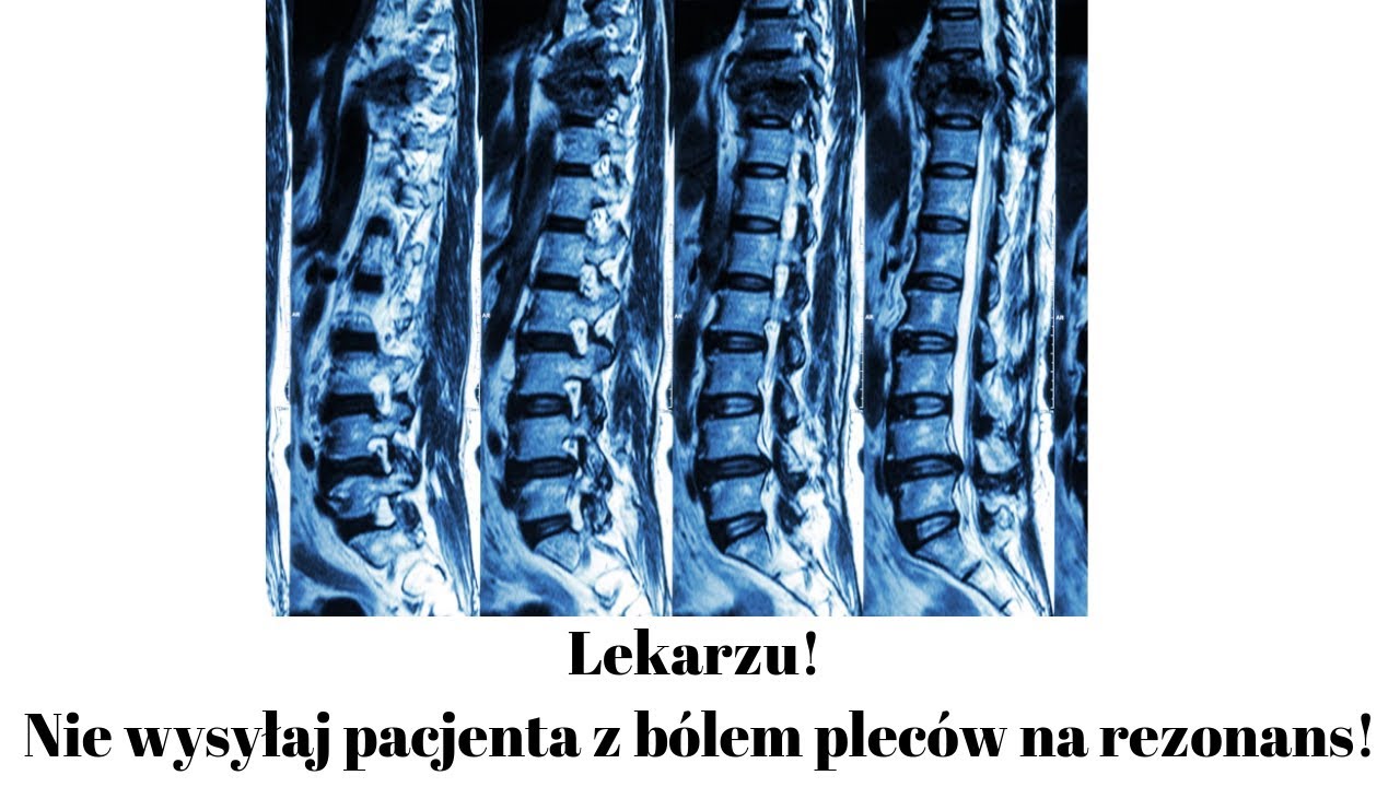 REZONANS MAGNETYCZNY KR GOS UPA Czy Warto Body Mind Clinic Bogna rezonans-magnetyczny-kr-gos-upa-czy-warto-body-mind-clinic-bogna