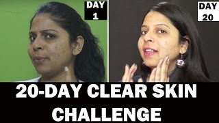 GIVEAWAY ALERT | Awesome DIY to Clear Acne Scars in a Week | Banana Peel treatment