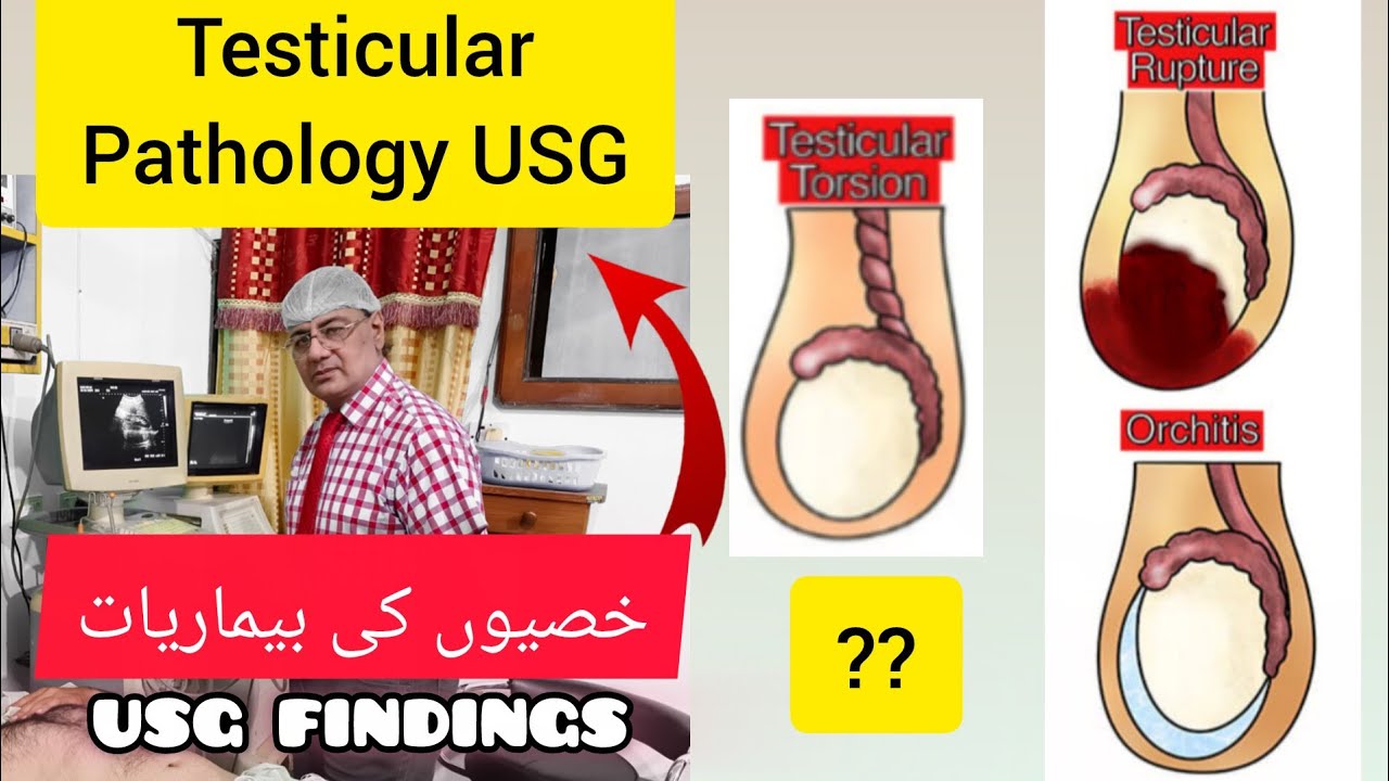 Testicular Pathology On Ultrasound Scan | Small Parts Ultrasound 
