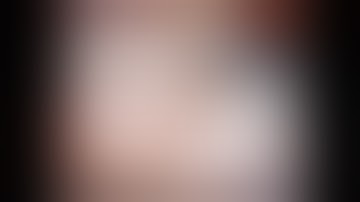 Robotic Right Hemicolectomy with CME