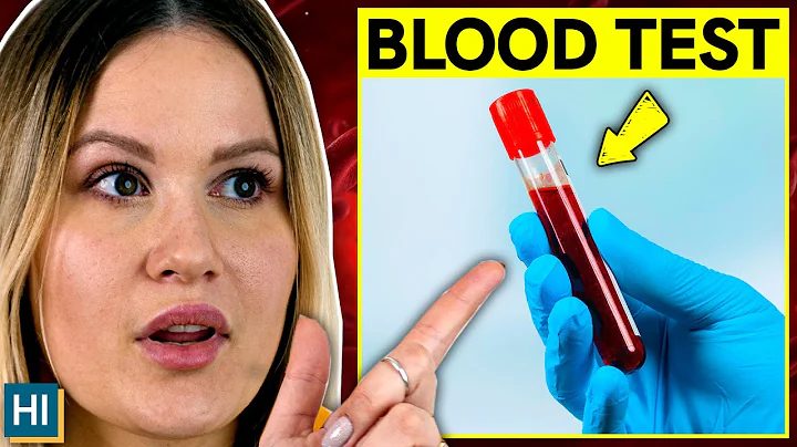 Fasting for a Blood Test: Dos and Dont’s