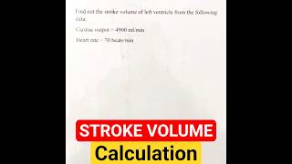 Can You Calculate Stroke Volume Correctly?