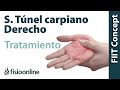 Tratamiento del síndrome de túnel carpiano derecho