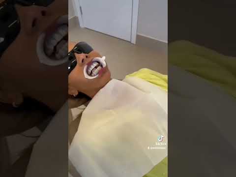 Vídeo: Como fazer o branqueador de dentes: 9 etapas (com fotos)