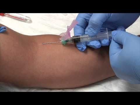 Phlebotomy: Syringe Draw Procedure