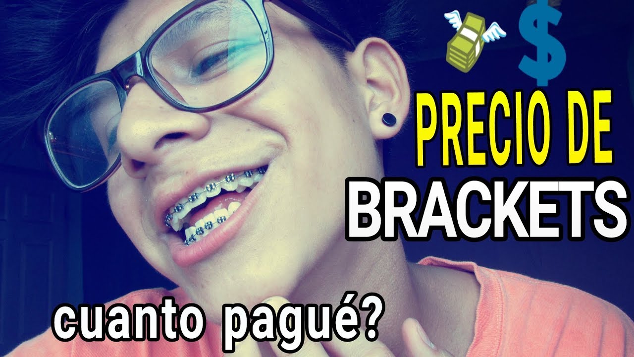 CUANTO CUESTA PONERSE BRACKETS? (ORTODONCIA) Mi experiencia!! YouTube