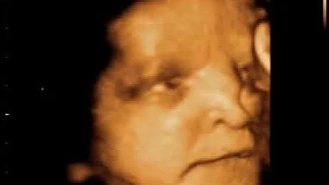 ¿Los bebés abren los ojos en el útero?